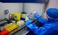 انجام بیش از 4هزار آزمایش تشخیصی کرونا در آزمایشگاه ویروس شناسی 